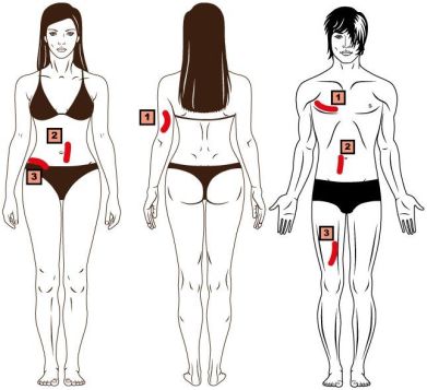 3 Faltenmethode K&ouml;rperfettmessung