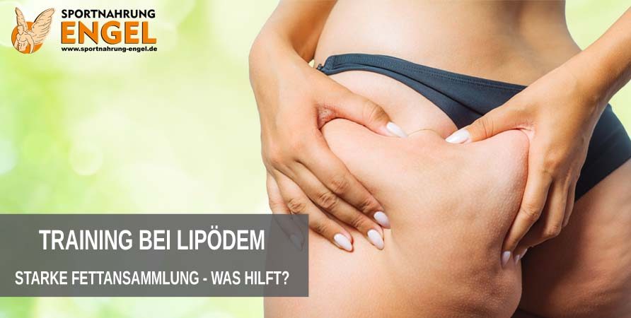 Wie Trainiere ich am Besten bei Lipödem Starke Fettansammlung welches Training hilft?